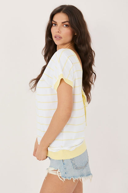 yellow short sleeve mini blouse detail view